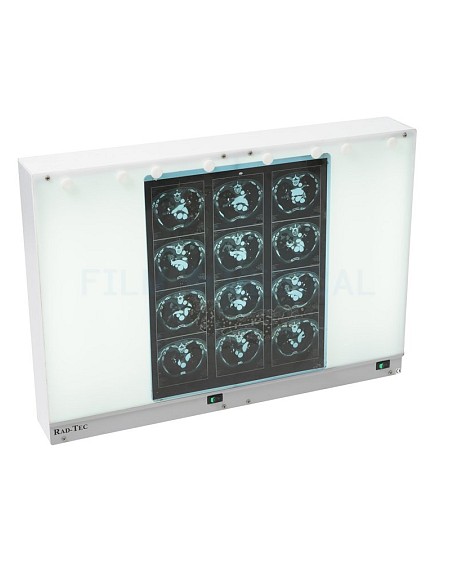 Rad-Tec X-Ray Double Lightbox